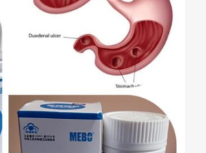 Mebo Gi Capsules (Ulcer Permanent Cure)