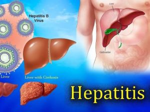 Total Cure For Hepatitis